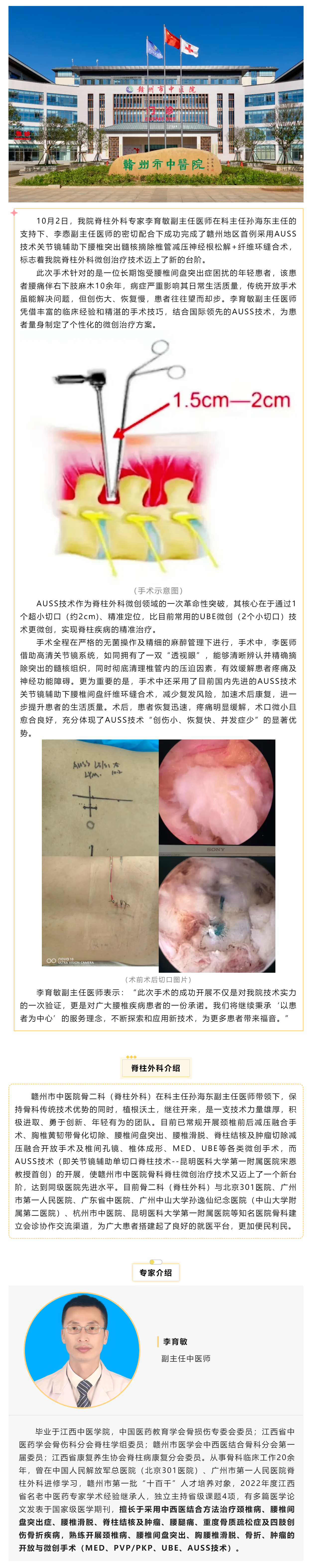 全市首例！我院成功實施AUSS技術(shù)關(guān)節(jié)鏡輔助下腰椎突出髓核摘除椎管減壓神經(jīng)根松解+纖維環(huán)縫合術(shù).png