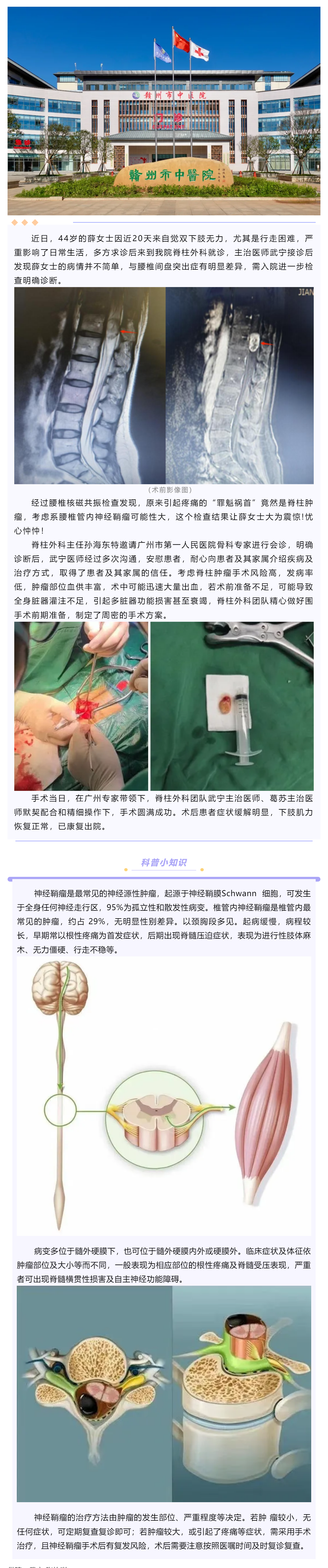 腰腿痛、下肢乏力麻木，提防神經(jīng)鞘瘤！.png