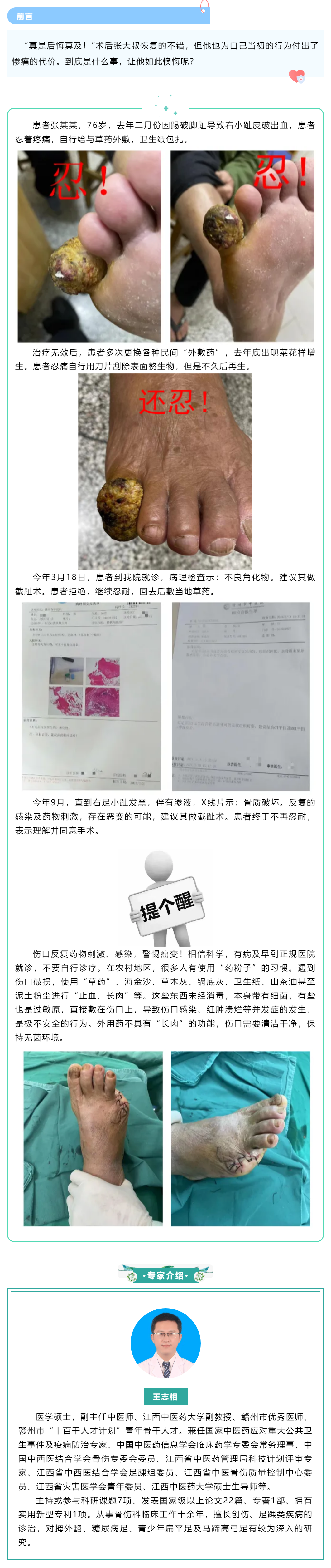 【病案實(shí)錄】小病忍、忍、忍，大病吃苦頭，多么痛的領(lǐng)悟！.png