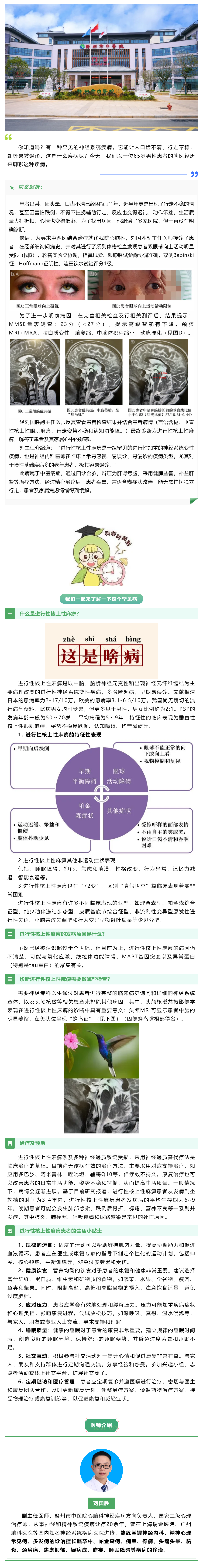 口齒不清、行走不穩(wěn)？警惕這種神經(jīng)系統(tǒng)罕見病——進(jìn)行性核上性麻痹.png