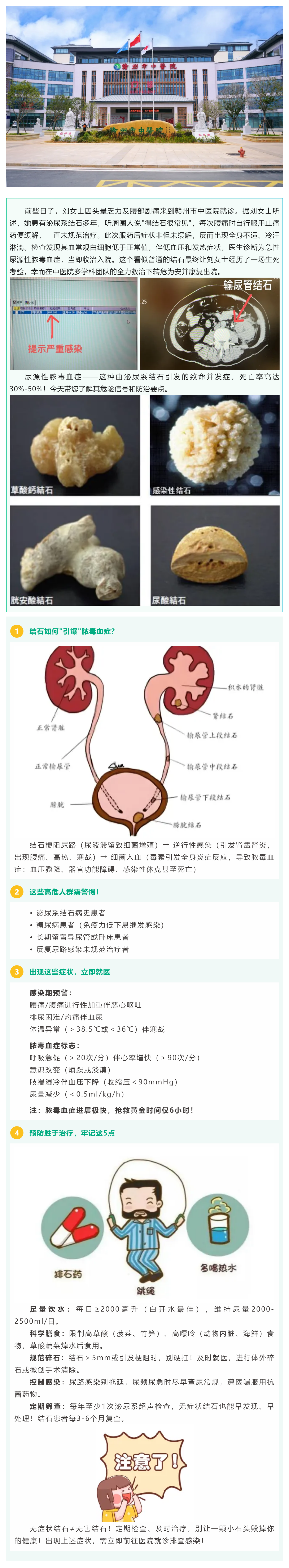 沉默的結(jié)石，暗藏的_致命危機(jī)_——警惕尿源性膿毒血癥！.png