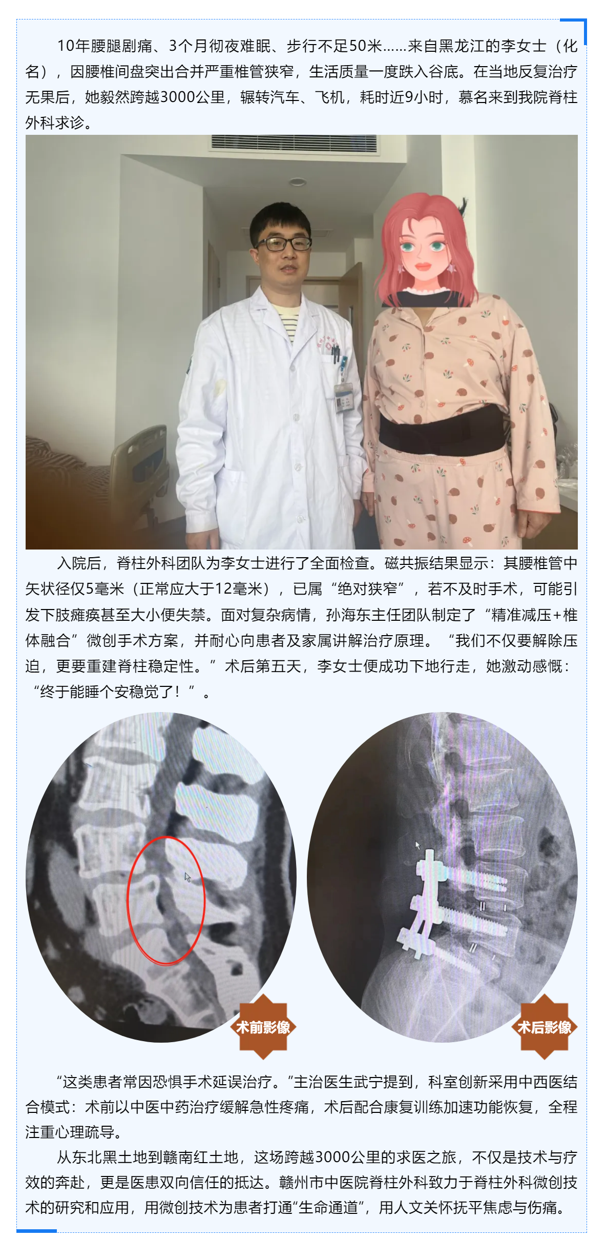 跨越山河的信任_贛州市中醫(yī)院巧手“疏堵”，腰椎狹窄患者3000公里求醫(yī)路終迎新生！.png